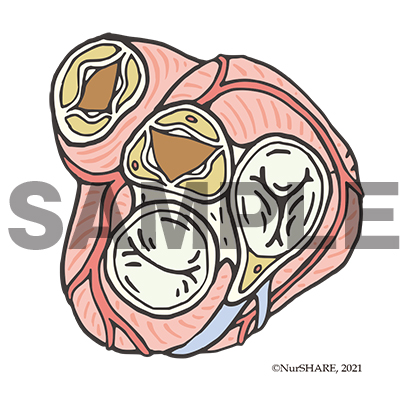 心臓の弁の構造[文字なし]【循環器】