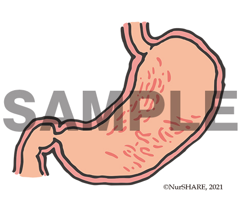 胃の構造（断面）[文字なし]【消化器】
