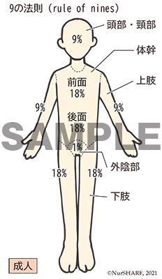 9の法則（熱傷面積）