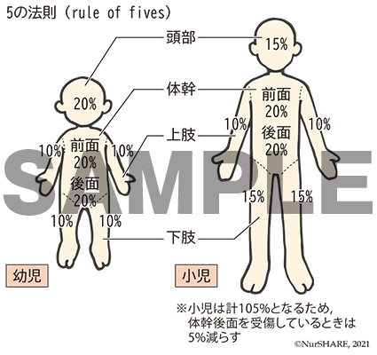 5の法則（熱傷面積）